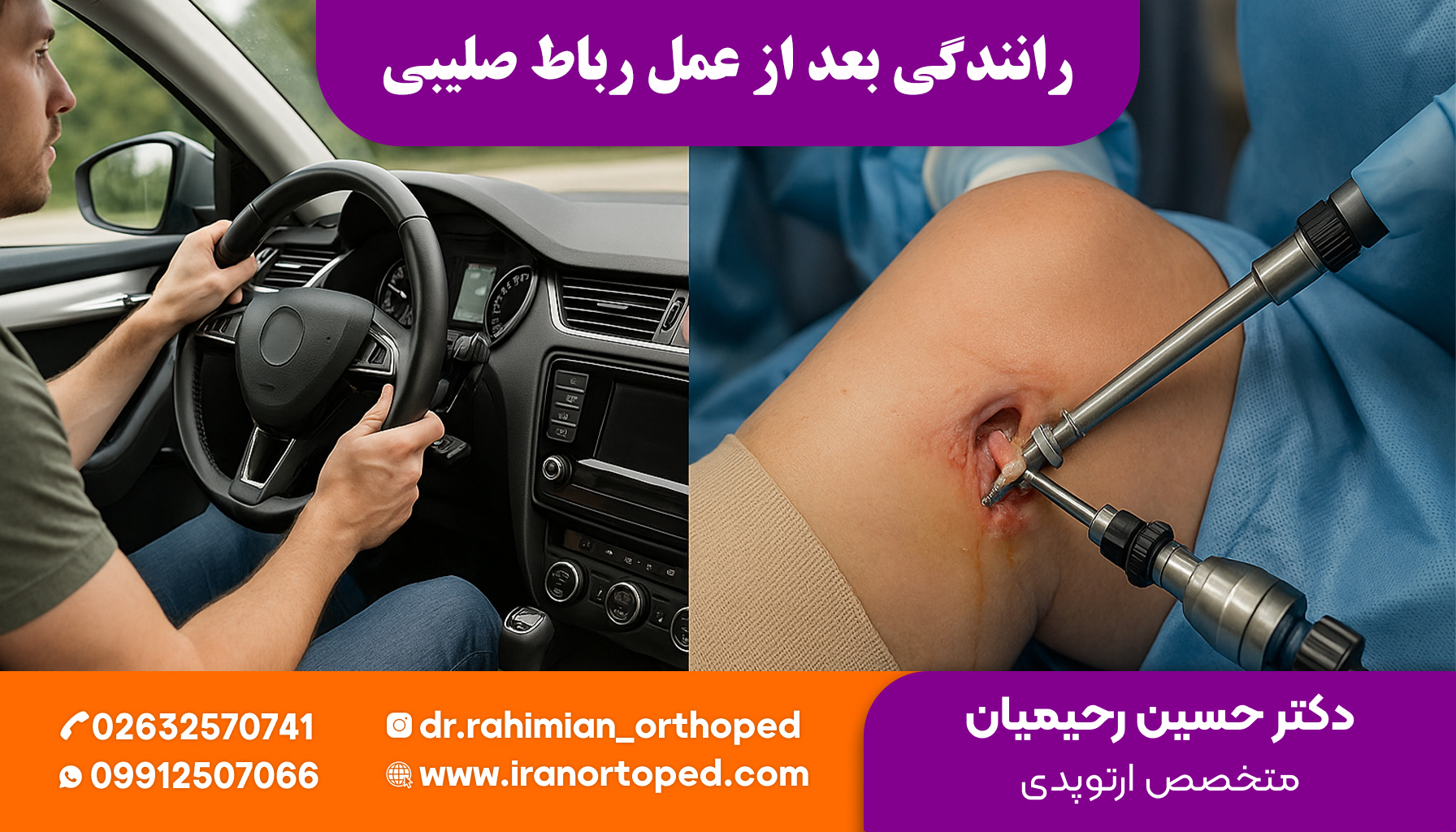 رانندگی بعد از عمل رباط صلیبی