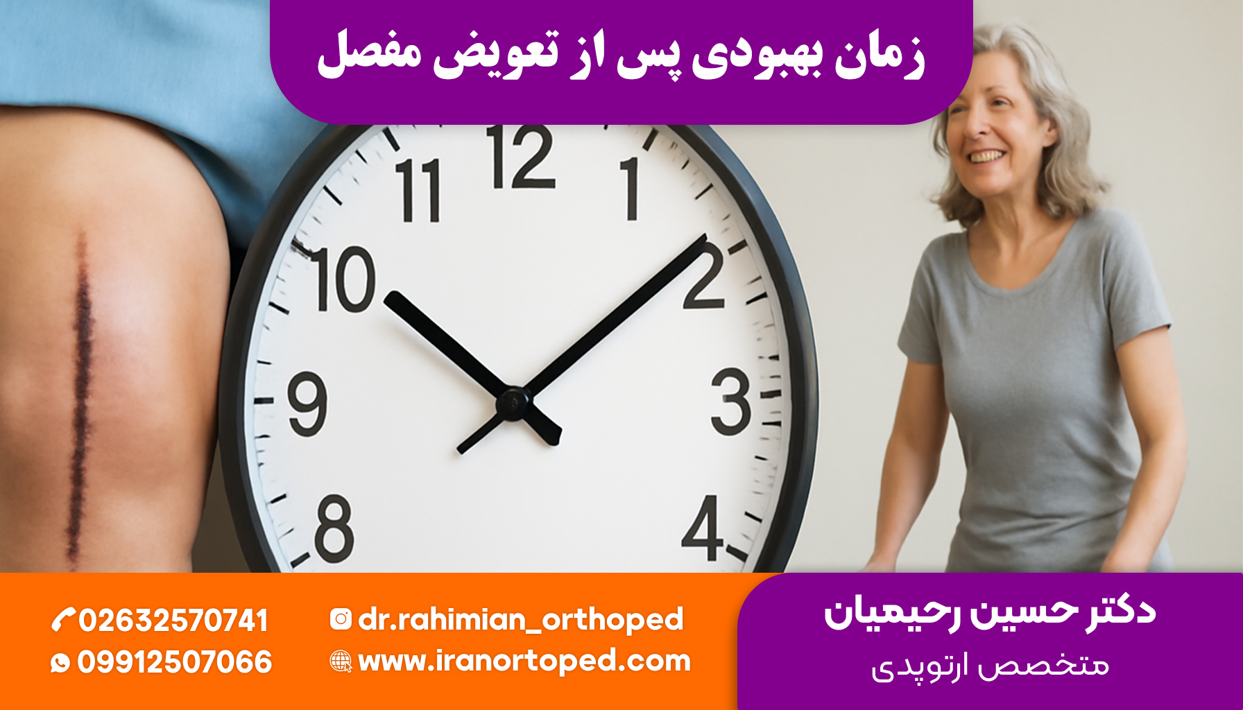 زمان بهبودی بعد از عمل تعویض مفصل زانو