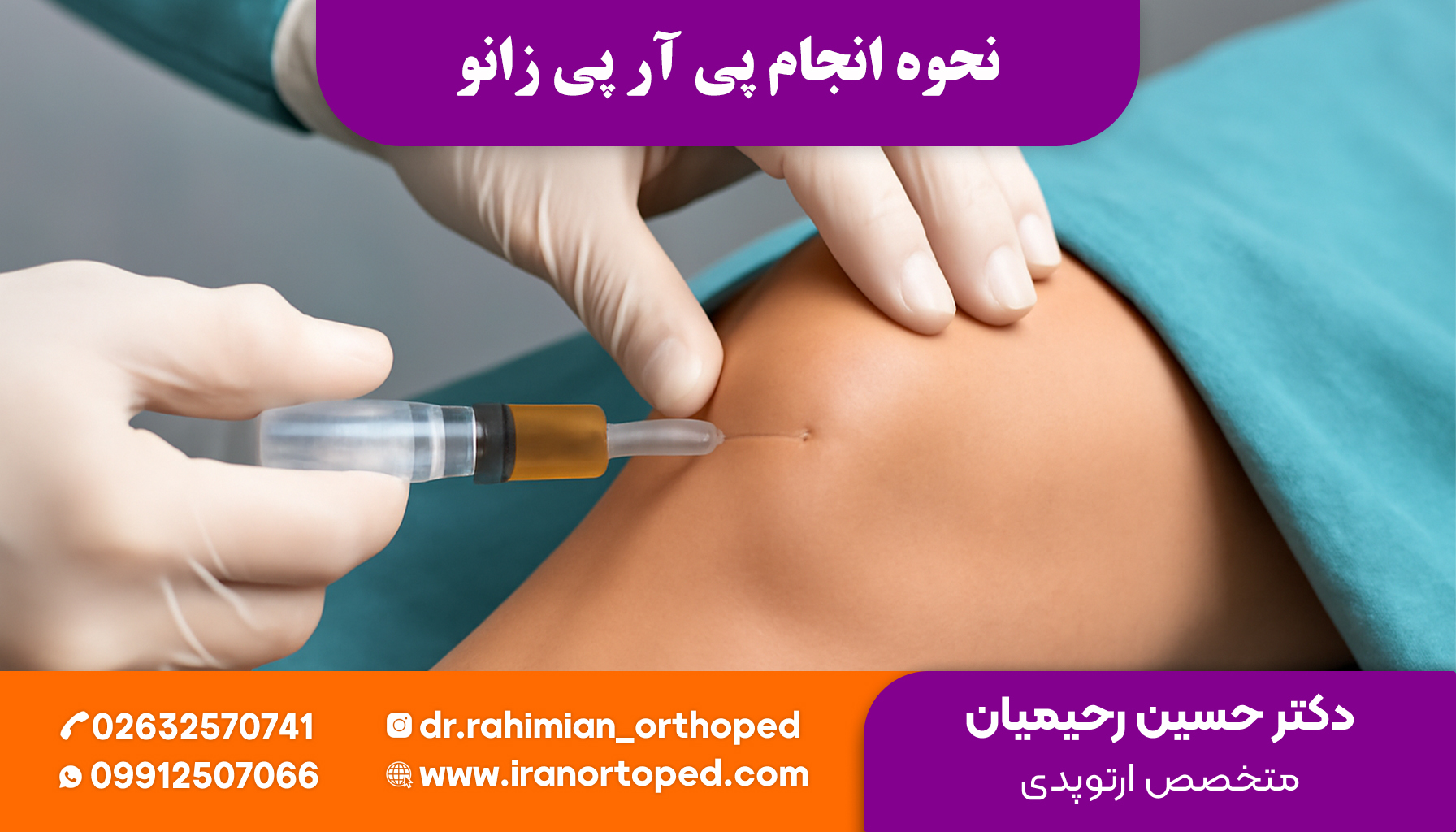 پی آر پی زانو چگونه انجام میشود