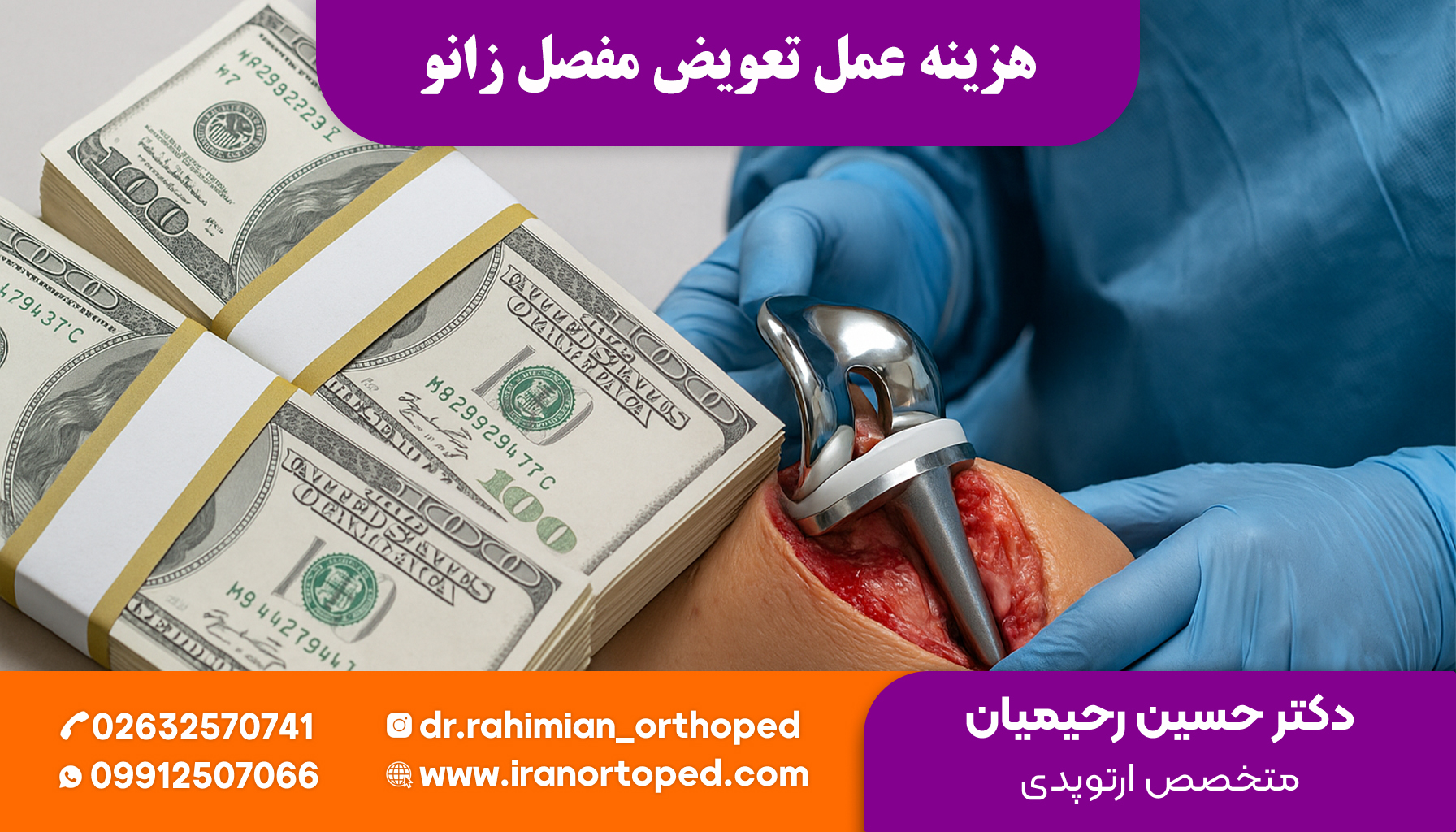 هزینه عمل تعویض مفصل زانو چقدر است