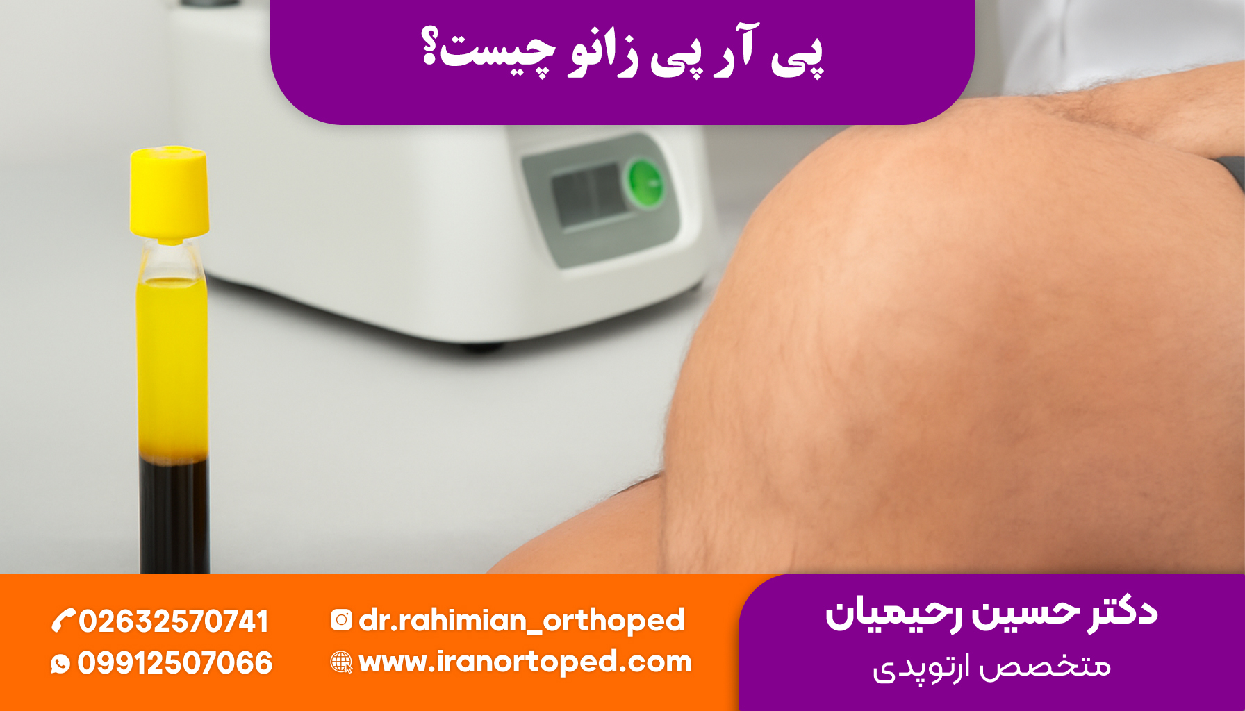 پی آر پی زانو چیست